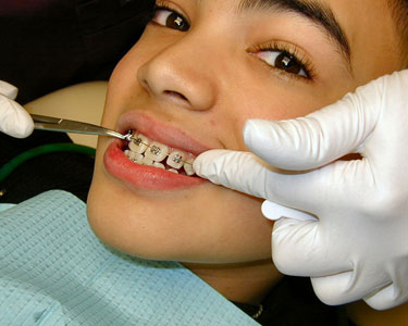 Kids Charlotte County and Southern Sarasota County: Orthodontists - Fun 4 Port Charlotte Kids